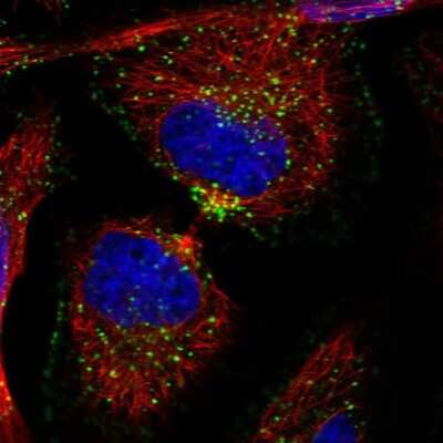 Immunocytochemistry/ Immunofluorescence: SNX1 Antibody [NBP2-13359]