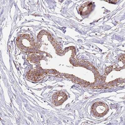 Immunohistochemistry-Paraffin: SNX1 Antibody [NBP2-13359]