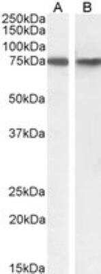 Western Blot: SNX1 Antibody [NBP1-46150]