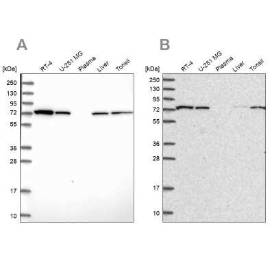 Western Blot: SNX1 Antibody [NBP2-13359]