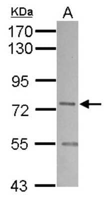 Western Blot: SNX1 Antibody [NBP2-20441]