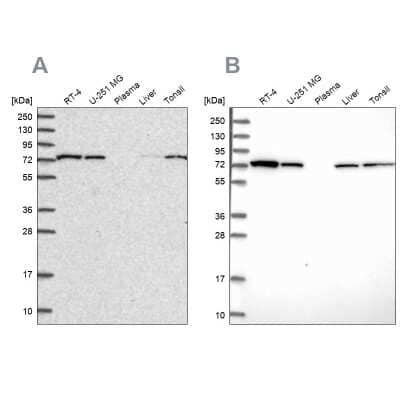 Western Blot: SNX1 Antibody [NBP2-56957]