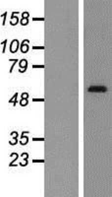 Western Blot: SNX1 Overexpression Lysate [NBP2-08038]