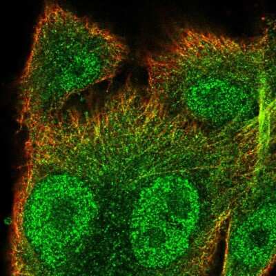 Immunocytochemistry/ Immunofluorescence: SNX10 Antibody [NBP2-56466]