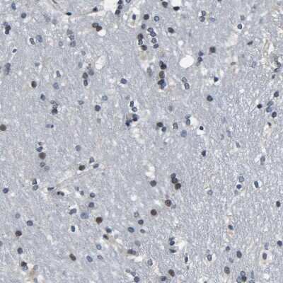 Immunohistochemistry-Paraffin: SNX10 Antibody [NBP1-86456]