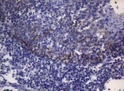 Immunohistochemistry: SNX10 Antibody (OTI6B7) - Azide and BSA Free [NBP2-74262]