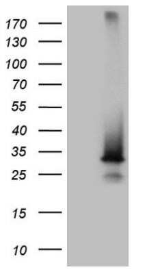 Western Blot: SNX10 Antibody (OTI6B7)Azide and BSA Free [NBP2-74262]