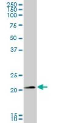 Western Blot: SNX10 Antibody [H00029887-B01P]