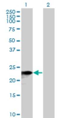 Western Blot: SNX10 Antibody [H00029887-B01P]