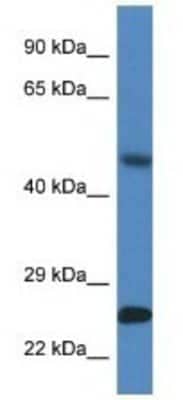 Western Blot: SNX10 Antibody [NBP1-79562]