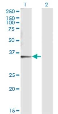 Western Blot: SNX11 Antibody (2G1) [H00029916-M05]