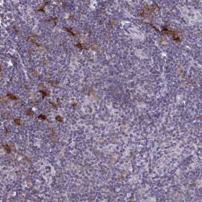 Immunohistochemistry: SNX11 Antibody [NBP2-38732]