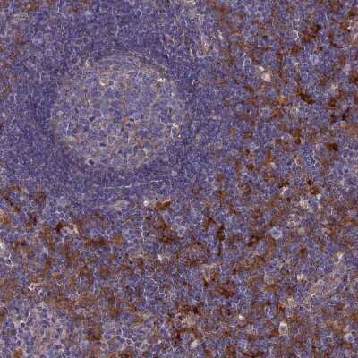 Immunohistochemistry-Paraffin: SNX11 Antibody [NBP1-85825]