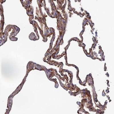 Immunohistochemistry-Paraffin: SNX11 Antibody [NBP1-85825]