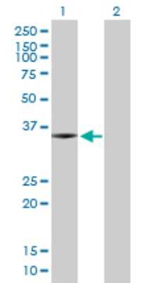 Western Blot: SNX11 Antibody [H00029916-D01P]