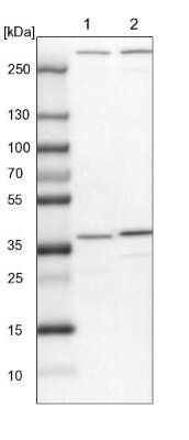 Western Blot: SNX11 Antibody [NBP1-85825]