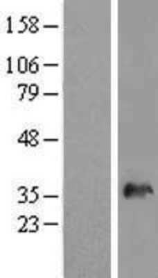 Western Blot: SNX11 Overexpression Lysate [NBL1-16302]