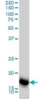 Western Blot: SNX12 Antibody (2C10) [H00029934-M01]