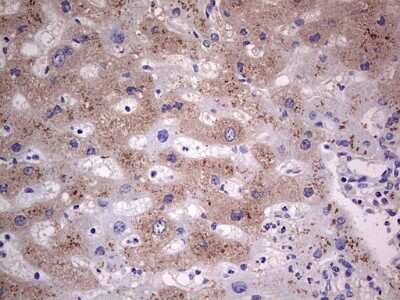 Immunohistochemistry: SNX12 Antibody (OTI3A4) [NBP2-45895]