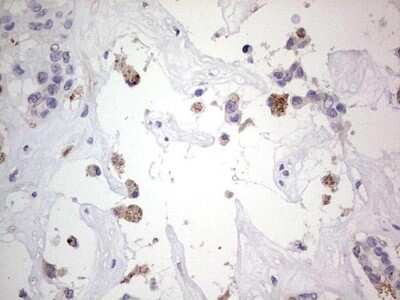 Immunohistochemistry: SNX12 Antibody (OTI3A4) [NBP2-45895]