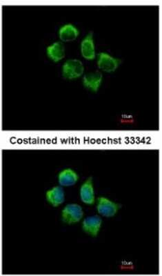 SNX12 Antibody (NBP1-31051) | Bio-Techne