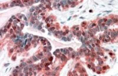 Immunohistochemistry-Paraffin: SNX12 Antibody [NB100-1206]