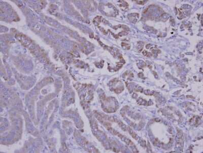 Immunohistochemistry-Paraffin: SNX12 Antibody [NBP1-31051]