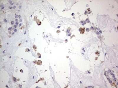 Immunohistochemistry: SNX12 Antibody (OTI3A4) - Azide and BSA Free [NBP2-74263]