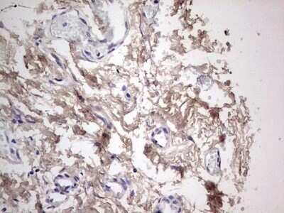Immunohistochemistry: SNX12 Antibody (OTI3A4) - Azide and BSA Free [NBP2-74263]