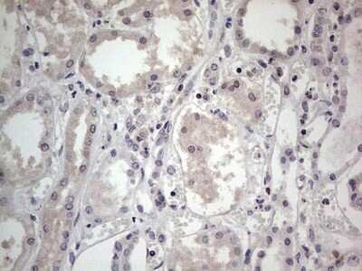 Immunohistochemistry: SNX12 Antibody (OTI3A4) - Azide and BSA Free [NBP2-74263]
