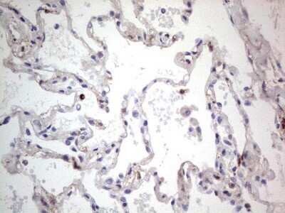 Immunohistochemistry: SNX12 Antibody (OTI3A4) - Azide and BSA Free [NBP2-74263]