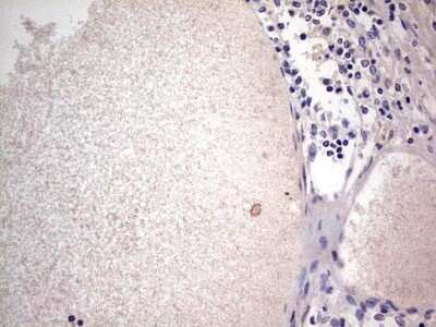 Immunohistochemistry: SNX12 Antibody (OTI3A4) - Azide and BSA Free [NBP2-74263]