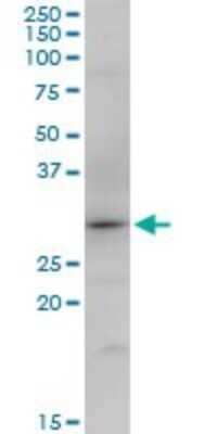 Western Blot: SNX12 Antibody [H00029934-B01P]