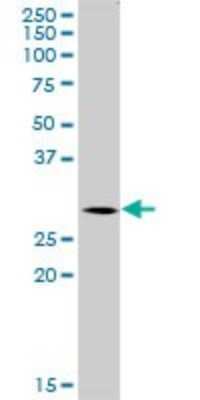 Western Blot: SNX12 Antibody [H00029934-B01P]