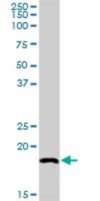 Western Blot: SNX12 Antibody [H00029934-D01P]