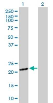 Western Blot: SNX12 Antibody [H00029934-D01P]