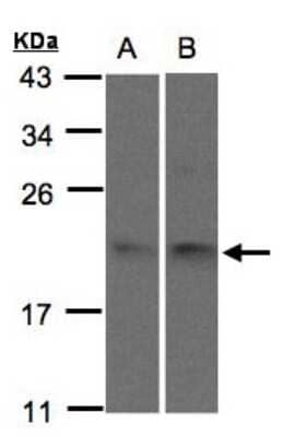 Western Blot: SNX12 Antibody [NBP1-31051]