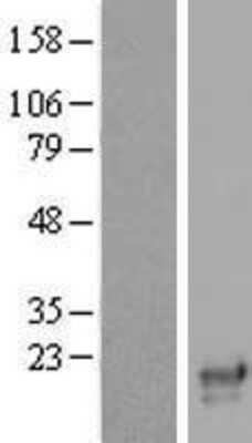 Western Blot: SNX12 Overexpression Lysate [NBP2-07418]