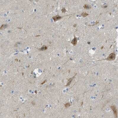 Immunohistochemistry-Paraffin: SNX14 Antibody [NBP1-80838]
