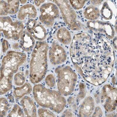 Immunohistochemistry-Paraffin: SNX14 Antibody [NBP1-80838]