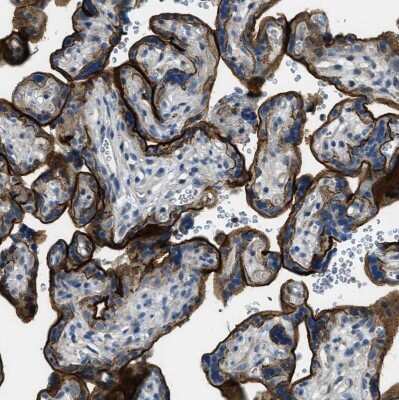 Immunohistochemistry-Paraffin: SNX14 Antibody [NBP1-80838]