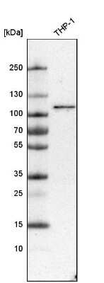 Western Blot: SNX14 Antibody [NBP1-80838]