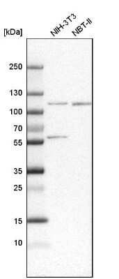 Western Blot: SNX14 Antibody [NBP1-80838]