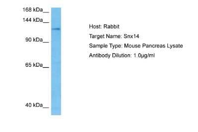 Western Blot: SNX14 Antibody [NBP2-83570]