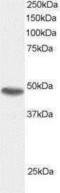 Western Blot: SNX15 Antibody [NB100-1210]