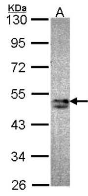 Western Blot: SNX15 Antibody [NBP1-33656]