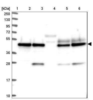 Western Blot: SNX15 Antibody [NBP1-85866]