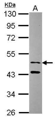 Western Blot: SNX15 Antibody [NBP2-20442]