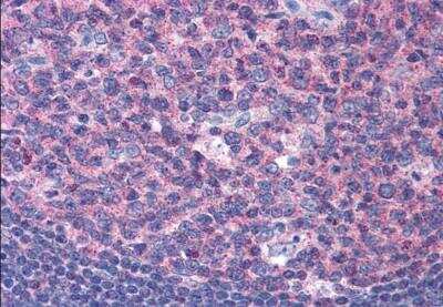 Immunohistochemistry-Paraffin: SNX16 Antibody [NB100-1211]