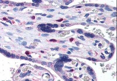 Immunohistochemistry-Paraffin: SNX16 Antibody [NB100-1211]